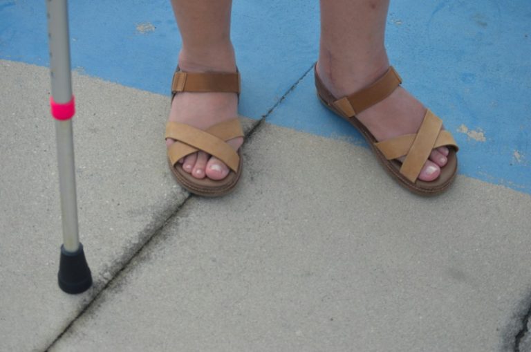 Кульгати уві сні: що це означає за сонником